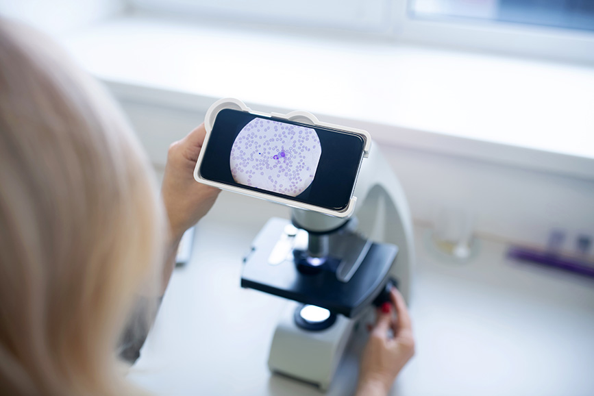 New Cellular Mechanism Discovery Offers Hope for Alzheimer’s Treatment